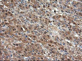 m05650 1 anti aminoacylase 1 acy1 mouse monoclonal antibody clone id oti1d4 ihc testing 7