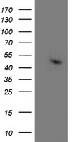 HEK293T cells were transfected with the pCMV6-ENTRY control (Left lane) or pCMV6-ENTRY ACY1 (Right lane) cDNA for 48 hrs and lysed