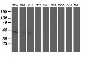 Western blot analysis of extracts (35ug) from 9 different cell lines by using anti-ACY1 monoclonal antibody