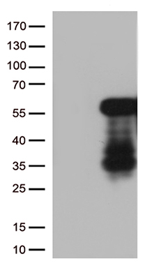HEK293T cells were transfected with the pCMV6-ENTRY control (Left lane) or pCMV6-ENTRY HOXA2 (Right lane) cDNA for 48 hrs and lysed