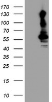 HEK293T cells were transfected with the pCMV6-ENTRY control (Left lane) or pCMV6-ENTRY KCNJ3 (Right lane) cDNA for 48 hrs and lysed