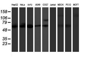 Western blot analysis of extracts (35ug) from 9 different cell lines by using anti-KCNJ3 monoclonal antibody