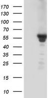 HEK293T cells were transfected with the pCMV6-ENTRY control (Left lane) or pCMV6-ENTRY KCNJ3 (Right lane) cDNA for 48 hrs and lysed