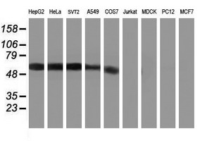 Western blot analysis of extracts (35ug) from 9 different cell lines by using anti-KCNJ3 monoclonal antibody