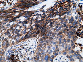 m05682 anti ketohexokinase khk mouse monoclonal antibody clone id oti3d1 ihc testing 10