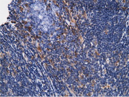 m05682 anti ketohexokinase khk mouse monoclonal antibody clone id oti3d1 ihc testing 11