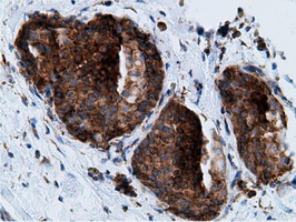 m05682 anti ketohexokinase khk mouse monoclonal antibody clone id oti3d1 ihc testing 12