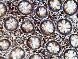 m05682 anti ketohexokinase khk mouse monoclonal antibody clone id oti3d1 ihc testing 13