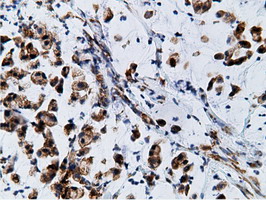 m05682 anti ketohexokinase khk mouse monoclonal antibody clone id oti3d1 ihc testing 14