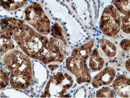 m05682 anti ketohexokinase khk mouse monoclonal antibody clone id oti3d1 ihc testing 15