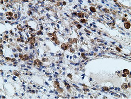 m05682 anti ketohexokinase khk mouse monoclonal antibody clone id oti3d1 ihc testing 16