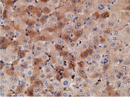 m05682 anti ketohexokinase khk mouse monoclonal antibody clone id oti3d1 ihc testing 17