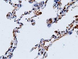 m05682 anti ketohexokinase khk mouse monoclonal antibody clone id oti3d1 ihc testing 18