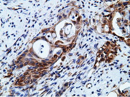 m05682 anti ketohexokinase khk mouse monoclonal antibody clone id oti3d1 ihc testing 4