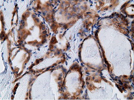 m05682 anti ketohexokinase khk mouse monoclonal antibody clone id oti3d1 ihc testing 5