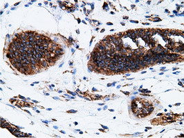 m05682 anti ketohexokinase khk mouse monoclonal antibody clone id oti3d1 ihc testing 6