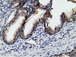 m05682 anti ketohexokinase khk mouse monoclonal antibody clone id oti3d1 ihc testing 7