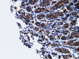 m05682 anti ketohexokinase khk mouse monoclonal antibody clone id oti3d1 ihc testing 8