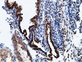 m05682 anti ketohexokinase khk mouse monoclonal antibody clone id oti3d1 ihc testing 9