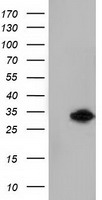 HEK293T cells were transfected with the pCMV6-ENTRY control (Left lane) or pCMV6-ENTRY KHK (Right lane) cDNA for 48 hrs and lysed