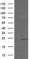 HEK293T cells were transfected with the pCMV6-ENTRY control (Left lane) or pCMV6-ENTRY RAB21 (Right lane) cDNA for 48 hrs and lysed