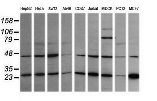 Western blot analysis of extracts (35ug) from 9 different cell lines by usin g anti-RAB21 monoclonal antibody (HepG2: human; HeLa: human; SVT2: mouse; A549: human; COS7: monkey; Jurkat: human; MDCK: canine; PC12: rat; MCF7: human)