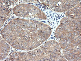 m05683 2 anti rab21 mouse monoclonal antibody clone id oti6f11 ihc testing 3