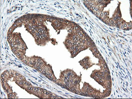 m05683 2 anti rab21 mouse monoclonal antibody clone id oti6f11 ihc testing 4
