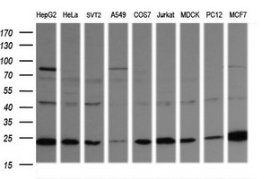 m05683 2 anti rab21 mouse monoclonal antibody clone id oti6f11 wb testing 2