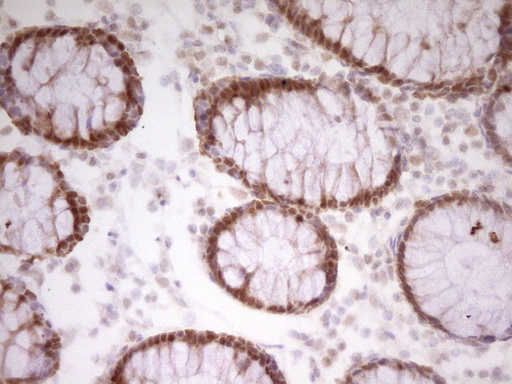 Immunohistochemical staining of paraffin-embedded Human colon tissue within the normal limits using anti-PAPSS2 mouse monoclonal antibody