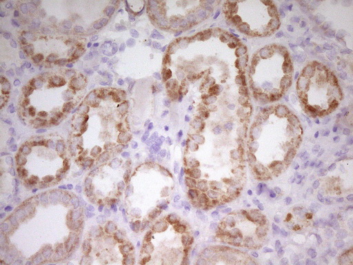 m05684 anti papss2 mouse monoclonal antibody clone id oti3h10 ihc testing 5
