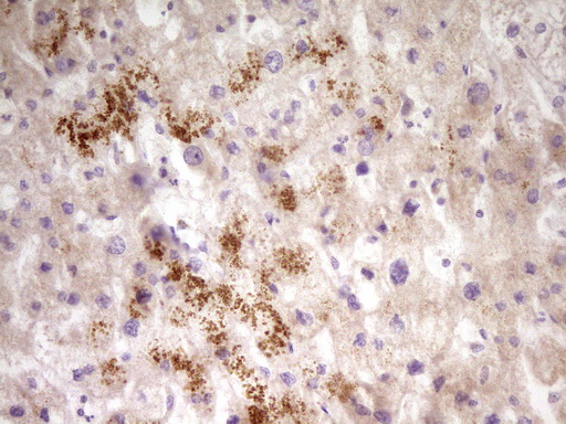 m05684 anti papss2 mouse monoclonal antibody clone id oti3h10 ihc testing 6