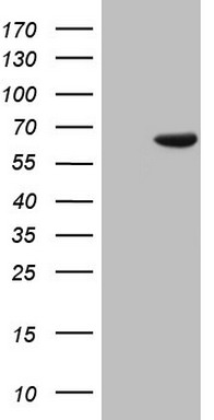 HEK293T cells were transfected with the pCMV6-ENTRY control (Left lane) or pCMV6-ENTRY PAPSS2 (Right lane) cDNA for 48 hrs and lysed