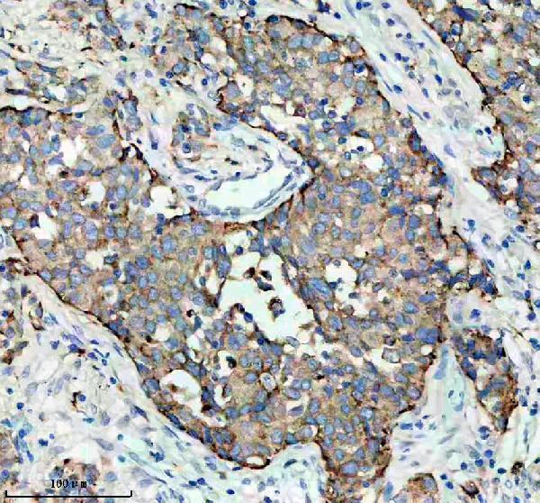 m05685 2 napsa primary antibodies ihc testing 1