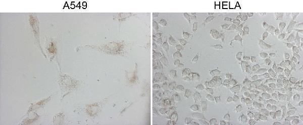 m05685 4 anti napsin a napsa mouse monoclonal antibody clone id oti3e5 if testing 6