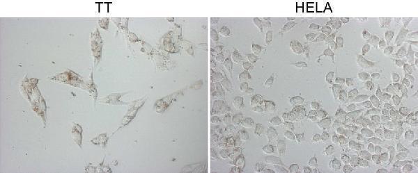 m05685 4 anti napsin a napsa mouse monoclonal antibody clone id oti3e5 if testing 7