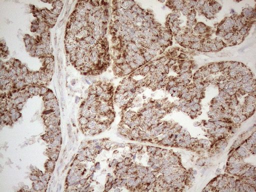 m05685 4 anti napsin a napsa mouse monoclonal antibody clone id oti3e5 ihc testing 1