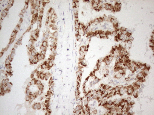 m05685 4 anti napsin a napsa mouse monoclonal antibody clone id oti3e5 ihc testing 2