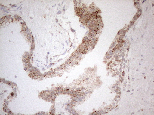 m05685 4 anti napsin a napsa mouse monoclonal antibody clone id oti3e5 ihc testing 3
