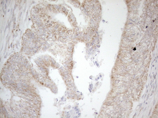 m05685 4 anti napsin a napsa mouse monoclonal antibody clone id oti3e5 ihc testing 4