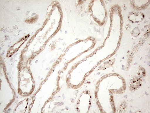 m05685 4 anti napsin a napsa mouse monoclonal antibody clone id oti3e5 ihc testing 5