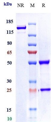 Anti-LIV-1/SLC39A6 Reference Antibody (ladiratuzumAb) on SDS-PAGE under reducing (R) condition