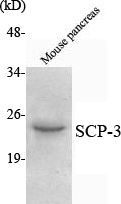 m05718 sycp3 primary antibodies wb testing 1