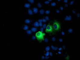 m05731 1 anti ppm1b mouse monoclonal antibody clone id oti3c9 if testing 5