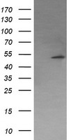 HEK293T cells were transfected with the pCMV6-ENTRY control (Left lane) or pCMV6-ENTRY PPM1B (Right lane) cDNA for 48 hrs and lysed