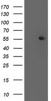 HEK293T cells were transfected with the pCMV6-ENTRY control (Left lane) or pCMV6-ENTRY PPM1B (Right lane) cDNA for 48 hrs and lysed