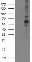 HEK293T cells were transfected with the pCMV6-ENTRY control (Left lane) or pCMV6-ENTRY PPM1B (Right lane) cDNA for 48 hrs and lysed