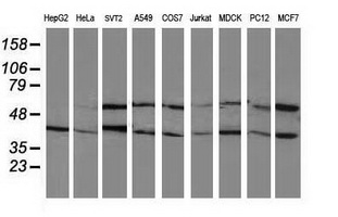 Western blot analysis of extracts (35ug) from 9 different cell lines by using anti-PPM1B monoclonal antibody