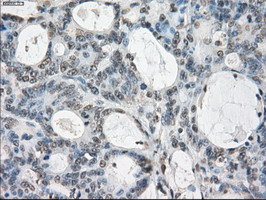 m05737 anti gbp2 mouse monoclonal antibody clone id oti5c8 ihc testing 11