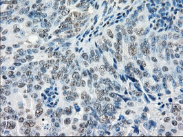 m05737 anti gbp2 mouse monoclonal antibody clone id oti5c8 ihc testing 4
